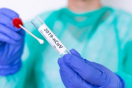Beneficios para socios de Aprocam en PCR para Covid-19  - Test de Saliva